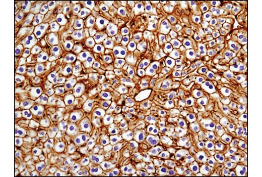 Immunohistochemistry Image 2: NT5E/CD73 (D7F9A) Rabbit Monoclonal Antibody