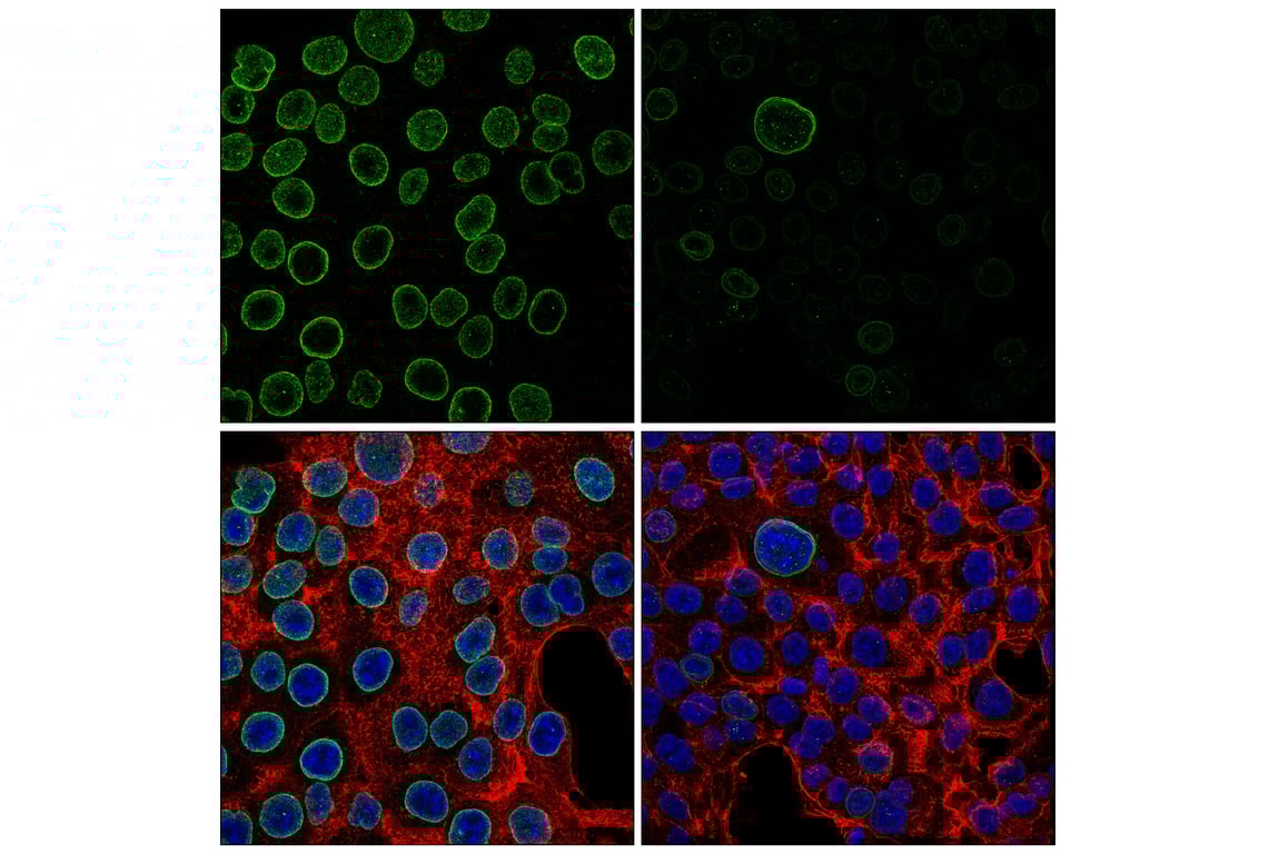 Immunofluorescence Image 1: POM121 (E3W3J) Rabbit Monoclonal Antibody