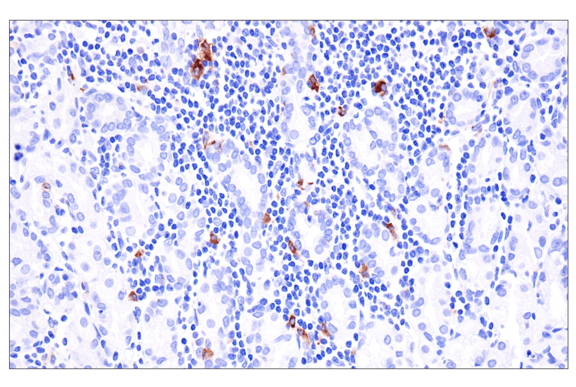 Immunohistochemistry Image 8: Langerin (F8L8I) Rabbit Monoclonal Antibody