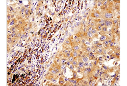 Immunohistochemistry Image 2: PLD2 (E1Y9L) Rabbit Monoclonal Antibody
