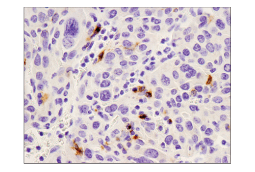 Immunohistochemistry Image 3: PD-L1 (D5V3B) Rabbit Monoclonal Antibody (BSA and Azide Free)