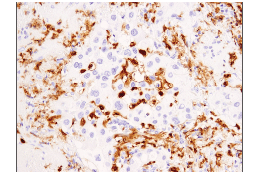 Immunohistochemistry Image 2: Syk (4D10) Mouse Monoclonal Antibody
