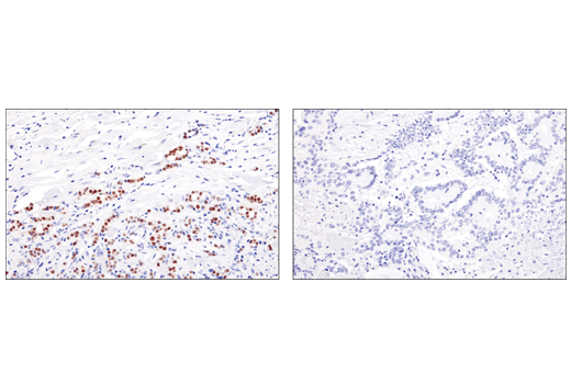 Immunohistochemistry Image 1: GATA-3 (E2N1Y) Mouse Monoclonal Antibody (BSA and Azide Free)