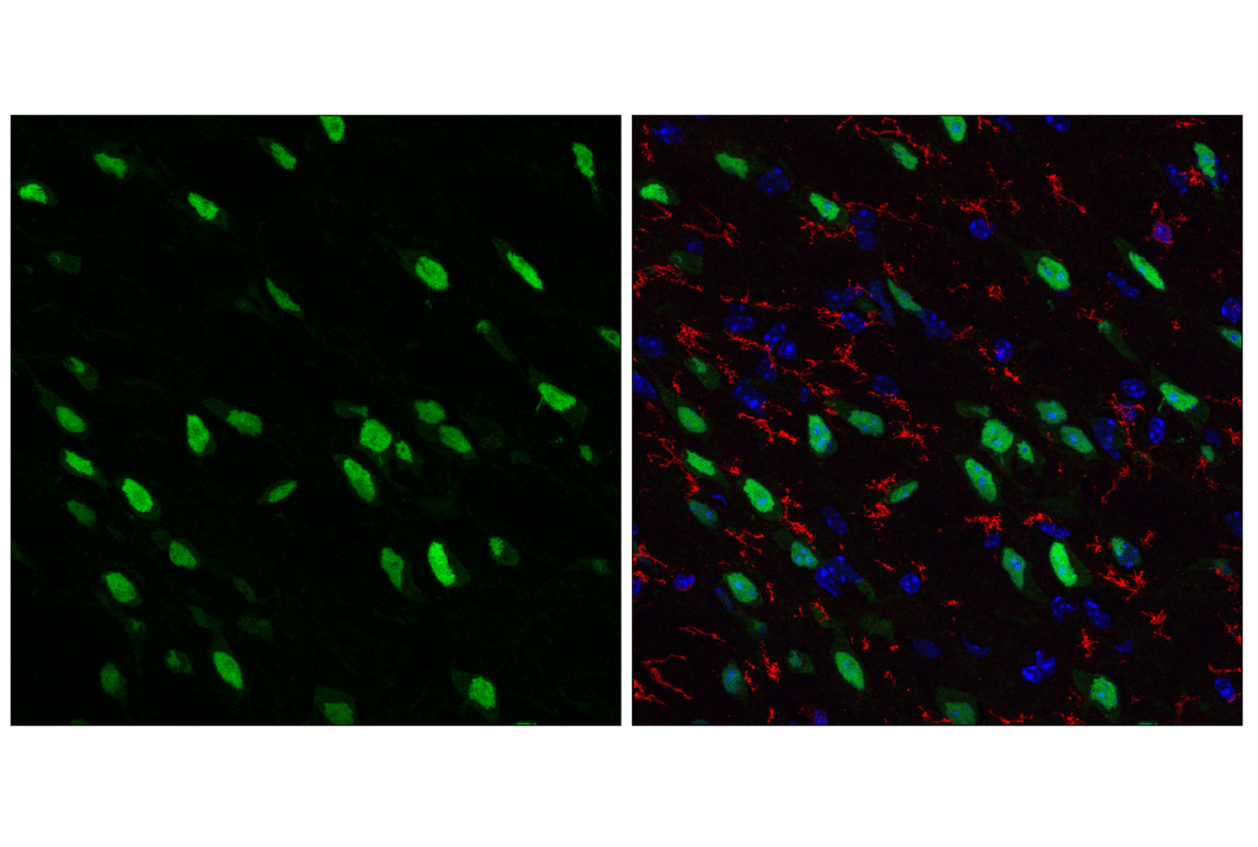 Immunofluorescence Image 1: SIX3 (F1I1S) Rabbit Monoclonal Antibody