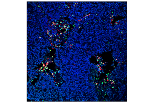 Immunohistochemistry Image 2: TUNEL Assay Kit (Fluorescence, 488 nm)