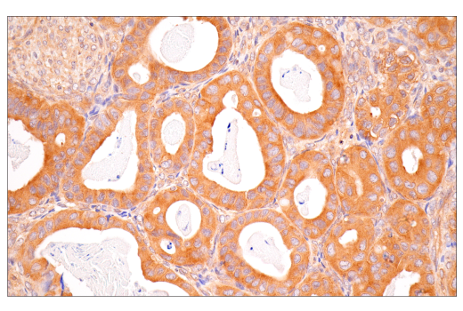 Immunohistochemistry Image 4: B-Raf (E3T5C) Mouse Monoclonal Antibody (BSA and Azide Free)