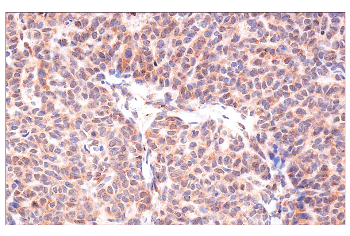 Immunohistochemistry Image 5: ADAR1 p150 Isoform (E6U1U) Rabbit Monoclonal Antibody (BSA and Azide Free)