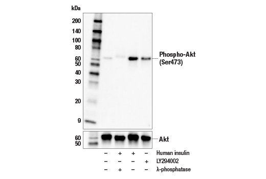 Western Blotting Image 2: Phospho-Akt (Ser473) (E4U3U) Mouse Monoclonal Antibody