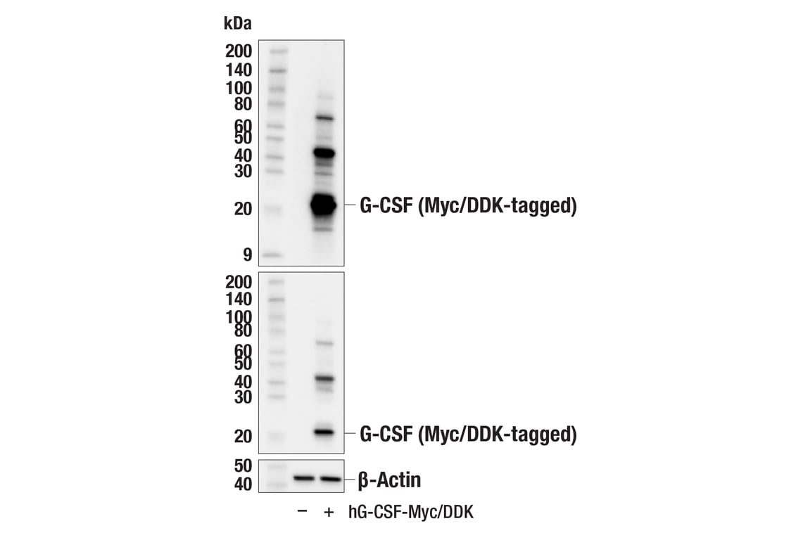 Western Blotting Image 2: G-CSF (E9S2E) Rabbit Monoclonal Antibody