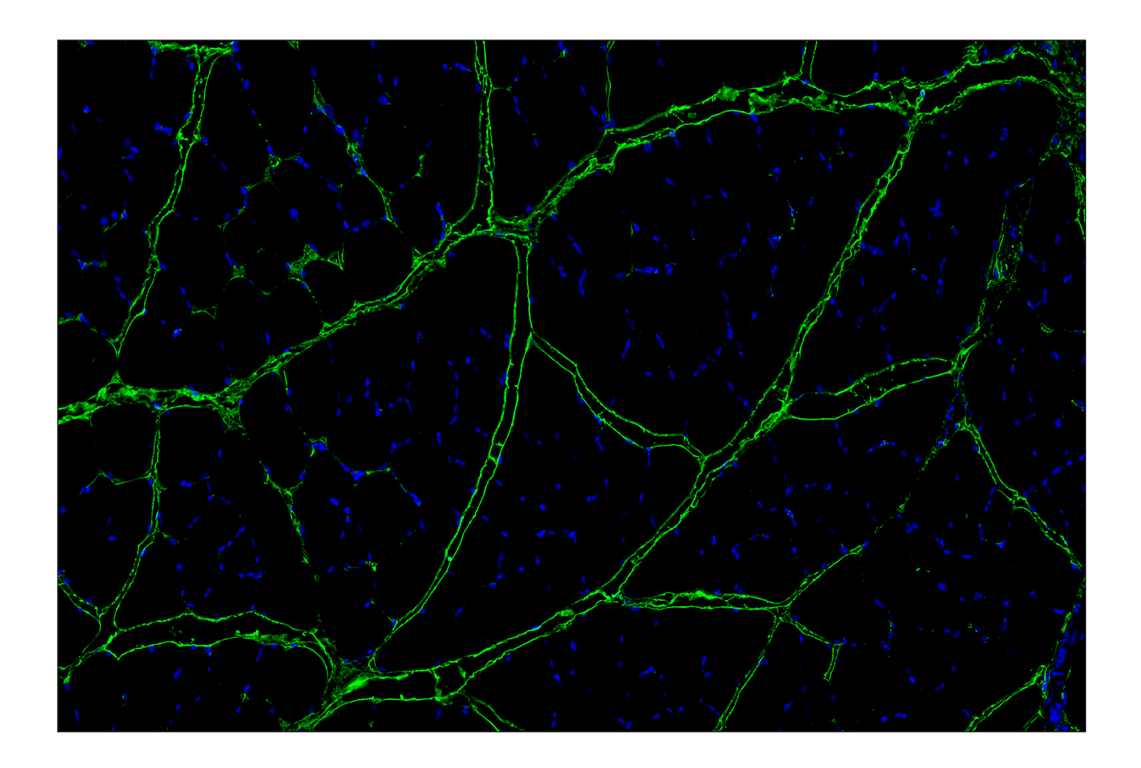 Immunohistochemistry Image 12: Hyaluronan Complete Tissue Staining Kit (Alexa Fluor<sup>®</sup> 488)