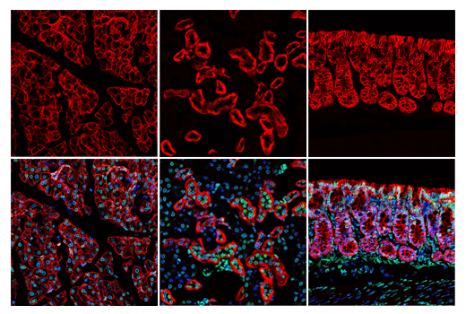 Immunofluorescence Image 1: EpCAM (E8Q1Z) Rabbit Monoclonal Antibody