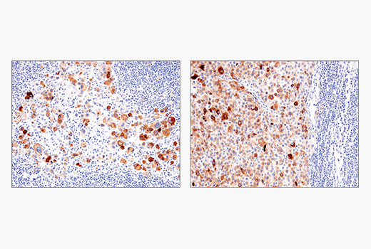 Immunohistochemistry Image 5: IL-13RA2/CD213a2 (E7U7B) Rabbit Monoclonal Antibody