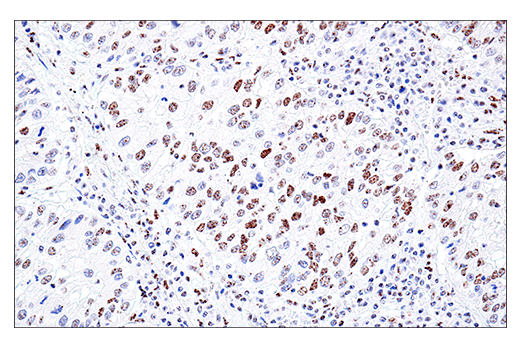 Immunohistochemistry Image 3: PML (E6S9L) Rabbit Monoclonal Antibody