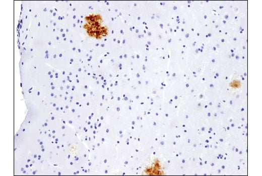 Immunohistochemistry Image 2: beta-Amyloid (pE3 Peptide) (D5N5H) Rabbit Monoclonal Antibody (BSA and Azide Free)