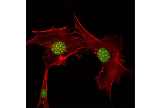 Immunofluorescence Image 1: HP1β (D2F2) XP<sup>®</sup> Rabbit mAb