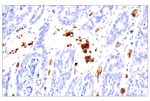 Immunohistochemistry Image 7: CD235a/Glycophorin A (JC159) Rabbit Monoclonal Antibody