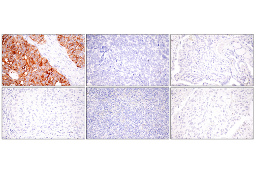 Immunohistochemistry Image 2: Claudin-6 (E7U2O) XP<sup>®</sup> Rabbit mAb