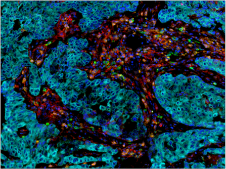 Immunohistochemical analysis of paraffin-embedded  spleen using FoxP3 (D6O8R) Rabbit mAb