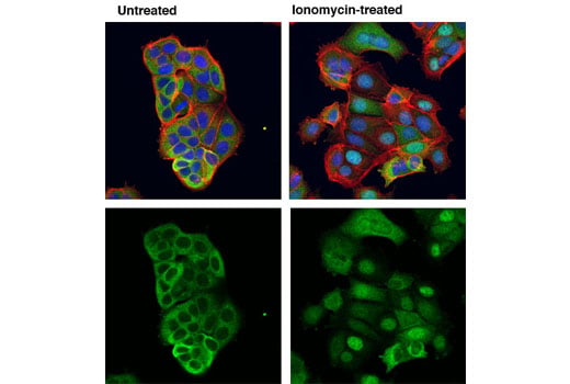 Immunofluorescence Image 1: NFAT1 (D43B1) Rabbit Monoclonal Antibody