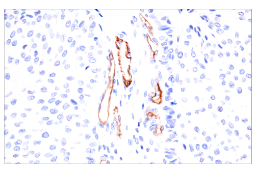 Immunohistochemistry Image 3: PODXL (E8O1S) Rabbit Monoclonal Antibody (BSA and Azide Free)