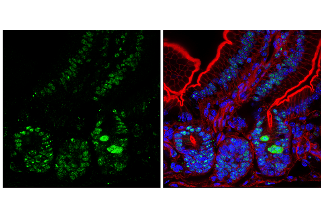 Immunofluorescence Image 2: NPM1 (E7W4P) Rabbit Monoclonal Antibody