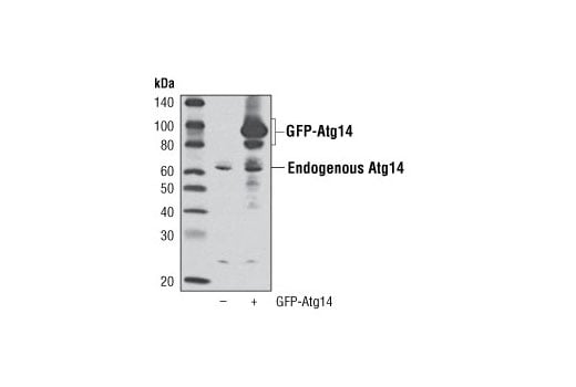 undefined Image 17: Autophagy Vesicle Nucleation Antibody Sampler Kit