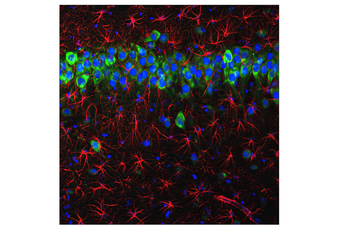 Immunofluorescence Image 1: GFAP (GA5) Mouse Monoclonal Antibody