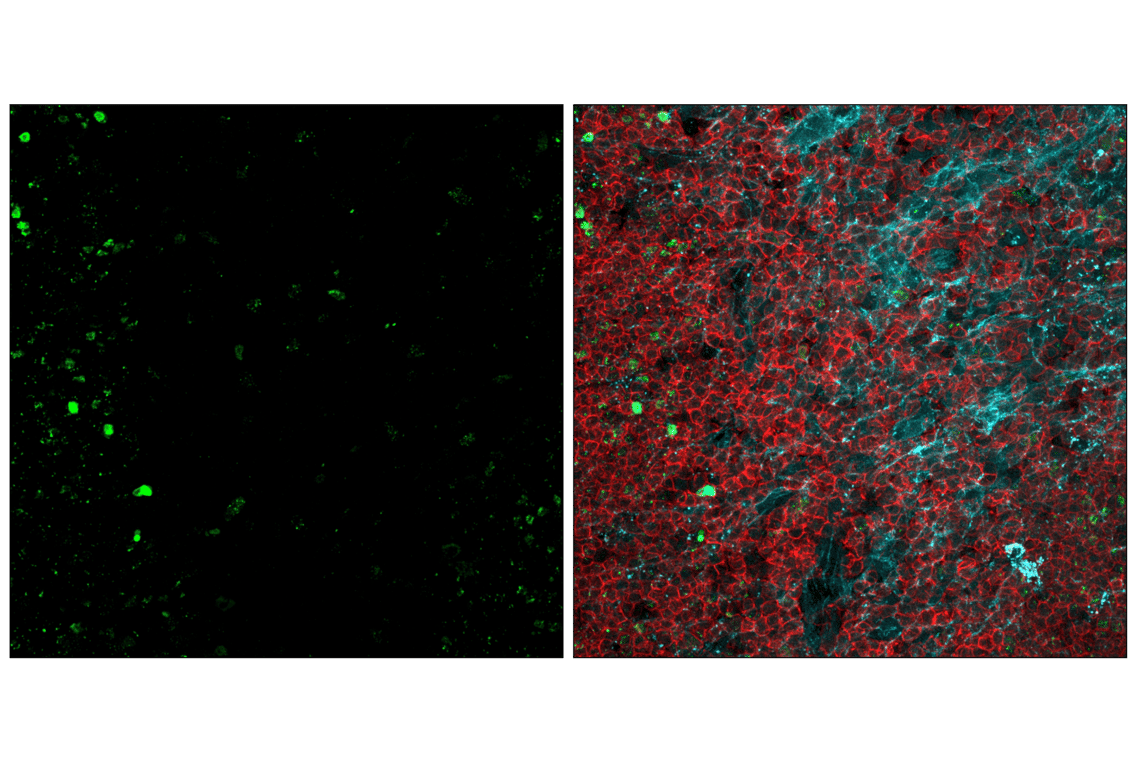 Immunofluorescence Image 2: Phospho-Histone H2A.X (Ser139) (20E3) Rabbit Monoclonal Antibody