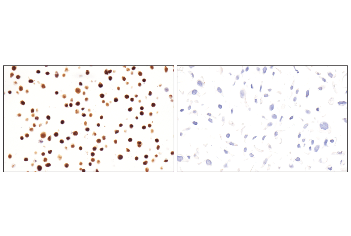 Immunohistochemistry Image 9: TCF1/TCF7 (E6O1K) Rabbit Monoclonal Antibody