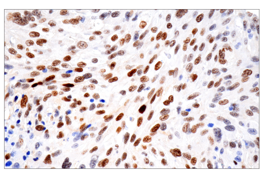 Immunohistochemistry Image 2: HIF-1 alpha (E1V6A) Rabbit Monoclonal Antibody (BSA and Azide Free)