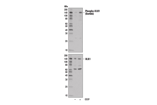 undefined Image 22: Autophagy Induction (ULK1 Complex) Antibody Sampler Kit