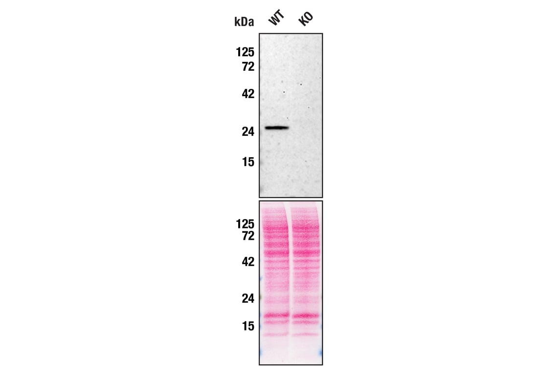 Western Blotting Image 2: Rab27A (D7V6B) Rabbit Monoclonal Antibody