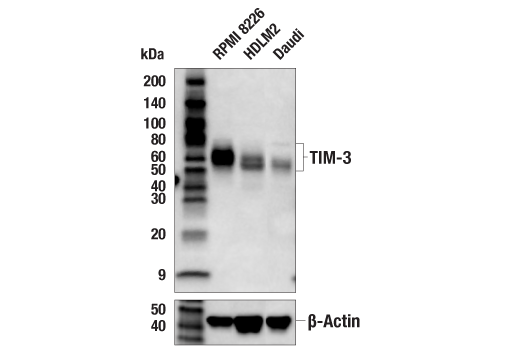 Western Blotting Image 2: TIM-3 (D5D5R) Rabbit Monoclonal Antibody