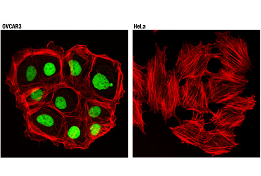 Immunofluorescence Image 1: PAX8 (D2S2I) Rabbit Monoclonal Antibody