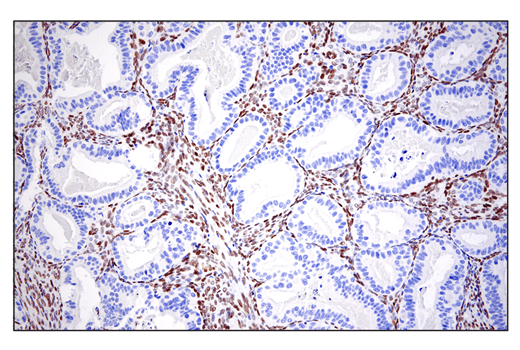 Immunohistochemistry Image 1: ZEB1 (E2G6Y) Rabbit Monoclonal Antibody (BSA and Azide Free)