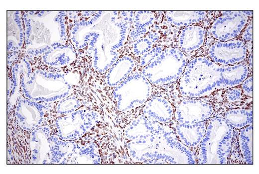 Immunohistochemistry Image 1: ZEB1 (E2G6Y) XP<sup>®</sup> Rabbit mAb (BSA and Azide Free)