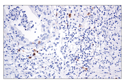 Immunohistochemistry Image 2: OX40 (ACT35) Mouse Monoclonal Antibody (BSA and Azide Free)