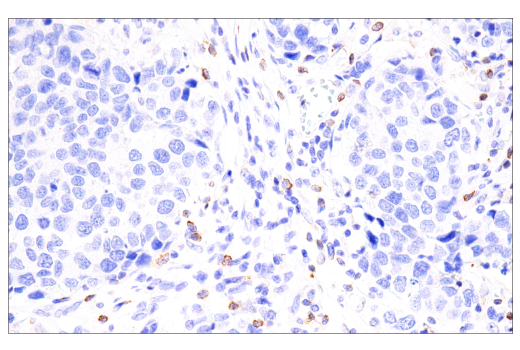 Immunohistochemistry Image 3: CTLA-4 (E2V1Z) Rabbit Monoclonal Antibody (BSA and Azide Free)