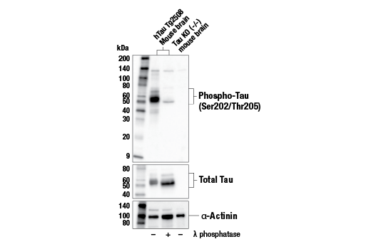 Western Blotting Image 2: Phospho-Tau (Ser202/Thr205) (E6S2W) Rabbit Monoclonal Antibody