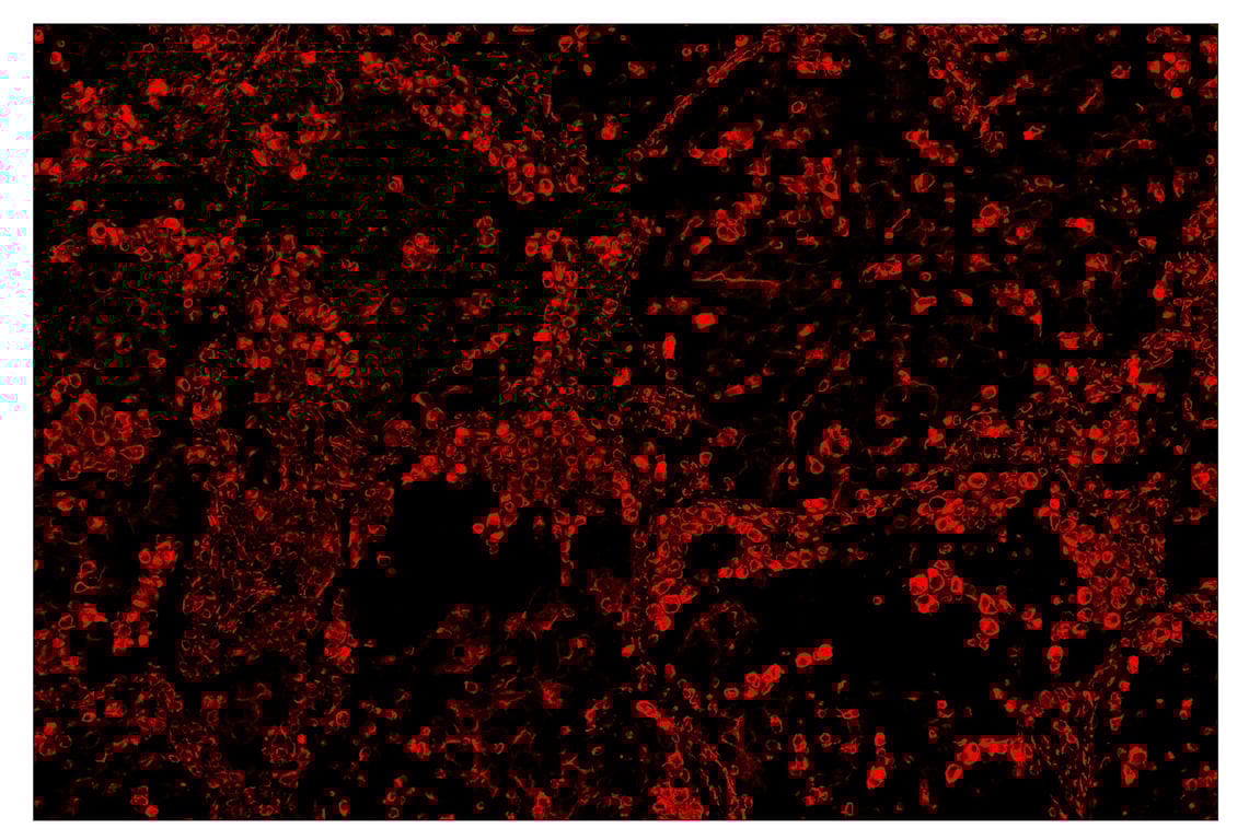 Immunohistochemistry Image 4: Vimentin (D21H3) & CO-0012-488 SignalStar<sup>™</sup> Oligo-Antibody Pair