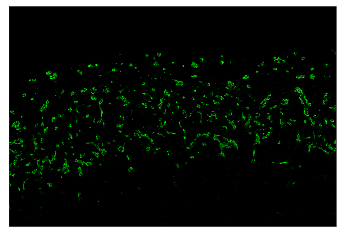 Immunohistochemistry Image 2: CD31 (PECAM-1) (D8V9E) & CO-0050-647 SignalStar<sup>™</sup> Oligo-Antibody Pair