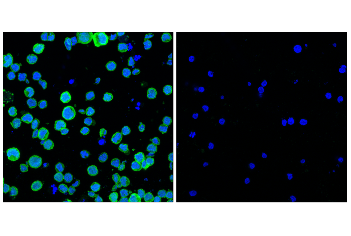 Immunofluorescence Image 1: PIP4K2C (E7P3S) Rabbit Monoclonal Antibody (BSA and Azide Free)