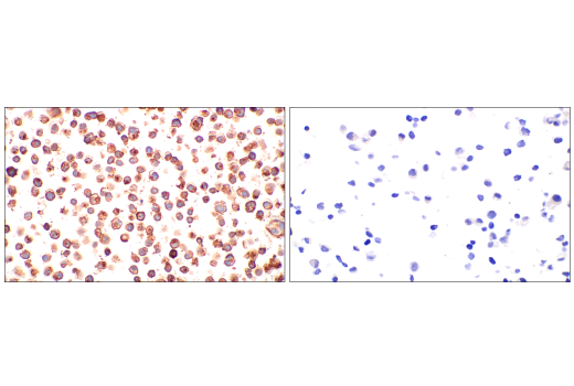 Immunohistochemistry Image 1: CD70 (E3Q1A) Rabbit Monoclonal Antibody (BSA and Azide Free)