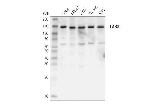 Western Blotting Image 1: LARS (D2N4M) Rabbit mAb