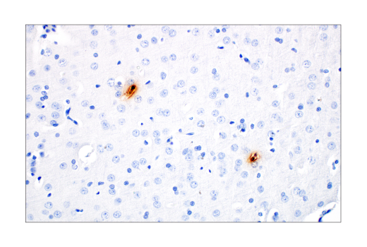 Immunohistochemistry Image 2: S100A9 (D3U8M) Rabbit Monoclonal Antibody (BSA and Azide Free)