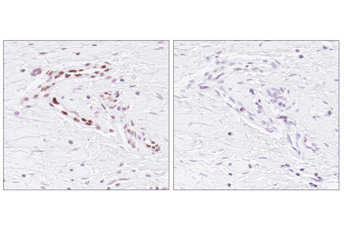 Immunohistochemistry Image 3: Phospho-Stat3 (Tyr705) (D3A7) XP<sup>®</sup> Rabbit mAb (BSA and Azide Free)