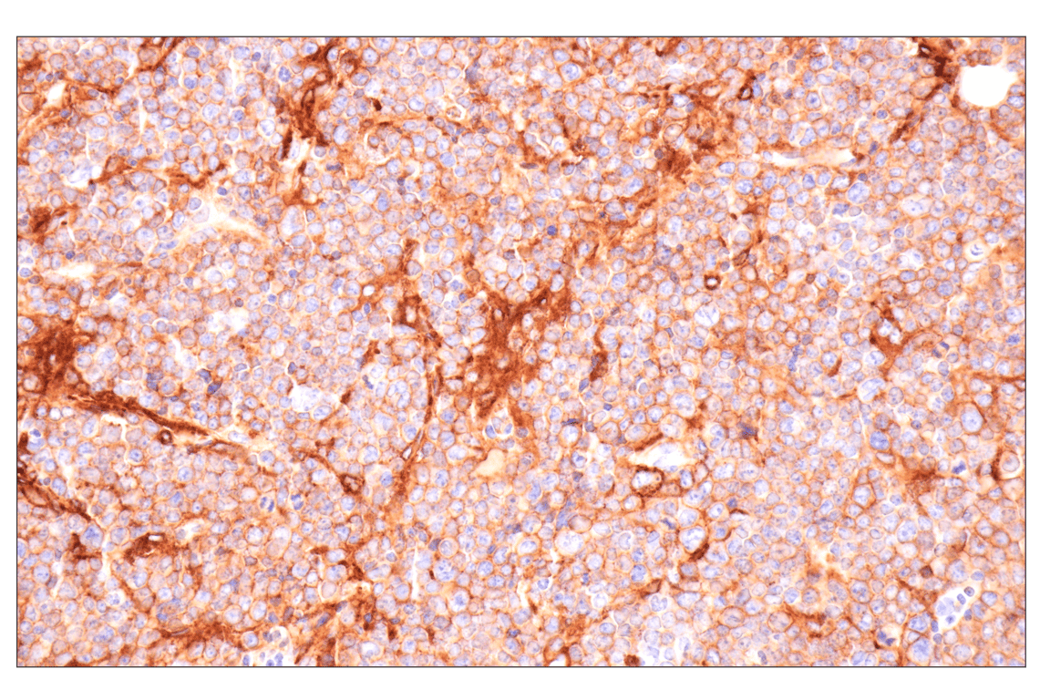 Immunohistochemistry Image 1: MHC Class II (I-E alpha) (F8N7J) Rabbit Monoclonal Antibody