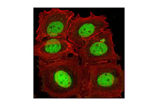 Immunofluorescence Image 1: JunB (C37F9) Rabbit Monoclonal Antibody (BSA and Azide Free)