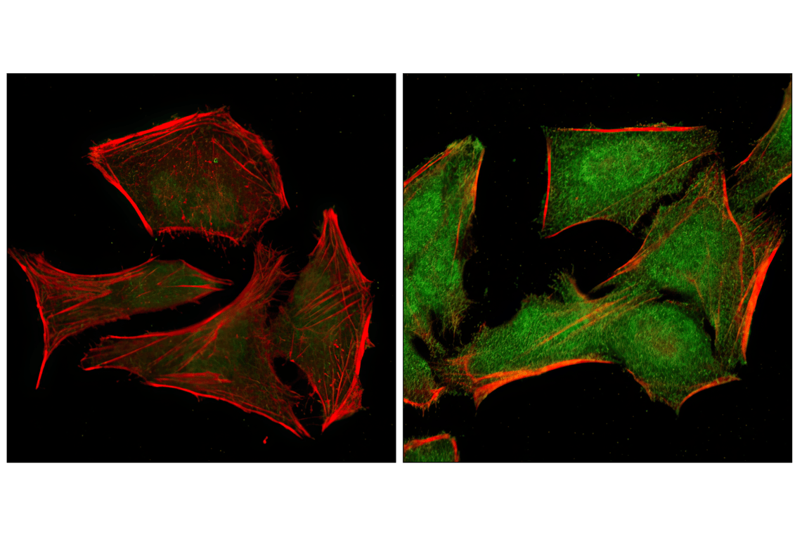 Immunofluorescence Image 1: Phospho-p38 MAPK (Thr180/Tyr182) (12F8) Rabbit mAb