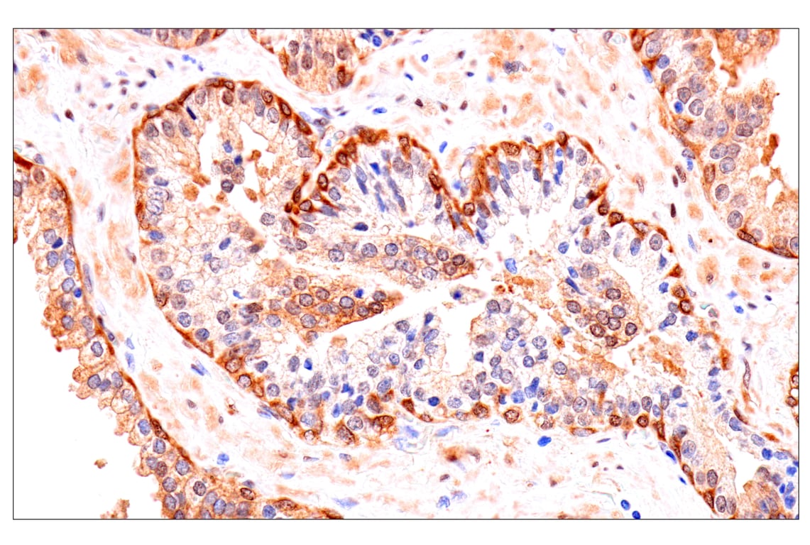 Immunohistochemistry Image 3: Phospho-YAP (Ser61) (E4Q8S) Rabbit Monoclonal Antibody
